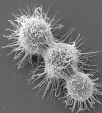 Image: Scanning electron micrograph of the fungus Cryptococcus neoformans (Photo courtesy of the Albert Einstein College of Medicine).